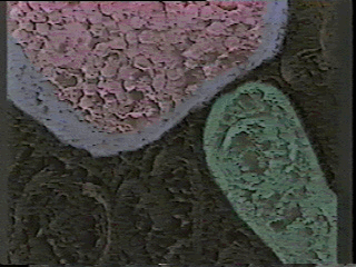 Actual photograph of a serotonin axon terminal (top), a dendrite (bottom), and the synapse in between.